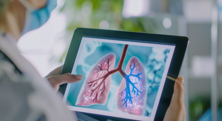 Impacto-de-los-Factores-Ambientales-en-la-Salud-Pulmonar